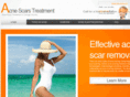 acnescars-orangecounty.com