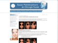 rhinoplastie-paris.org