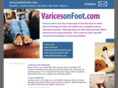 varicesonfoot.com