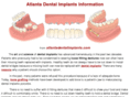 atlanta-implants.com