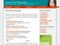 acnescarremedy.com