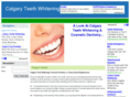 calgaryteethwhitening.org