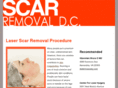 scarremovaldc.com