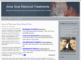 acnescarremovaltreatments.com