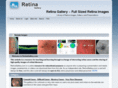 retinashare.com
