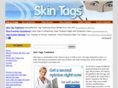 skintagremedies.com