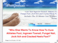 ingrowntoenailhometreatment.net