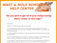 wartmoleremovalhelp.com