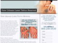 neworleanslasertattooremoval.com