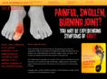 study4gout.com