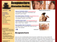 acupuncture4painrelief.com