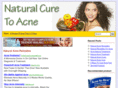 naturalcuretoacne.com