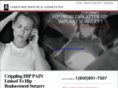 myhipimplantcase.com