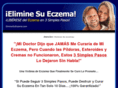 eliminesueczema.com