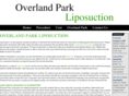 overlandparkliposuction.com