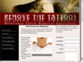 losethetoos.com