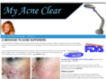 myacneclear.com