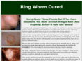 ringwormcured.com