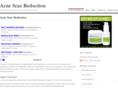 acnescarreduction.net