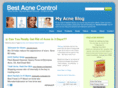 bestacnecontrol.com