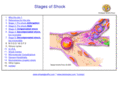 systemic-inflammatory-response-syndrome.com