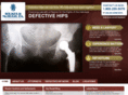 defectivehip.com