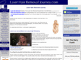 laser-hair-removal-journey.com