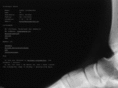 xn--stleschumacher-mib.com