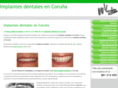 xn--implantes-corua-crb.com