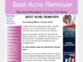 best-acne-remover.com