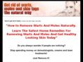 howtogetridofwarts.org
