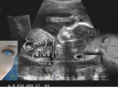 creepyfetus.com