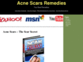 bestacnescarsremedies.com