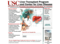 usclivertransplant.org