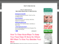 howtoclearacneup.net