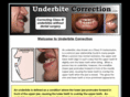 underbitecorrection.com