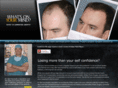 barrhairtransplant.com