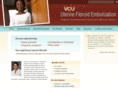 vcufibroids.com