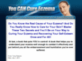 eczema-treatment-online.com