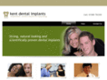 kentdentalimplants.net