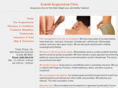 everettacupuncture.com