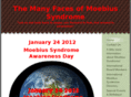 manyfacesofmoebiussyndrome.com