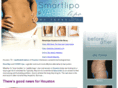 smartlipo-vaser-houston.com