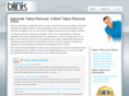 edmondstattooremoval.com