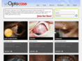 optocase.com