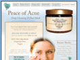 peaceofacne.com