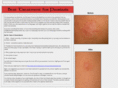 besttreatmentforpsoriasis.net