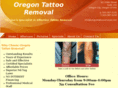 oregontattooremoval.com