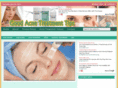 goodacnetreatmenttips.com