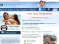 laserhairlossclinic.com